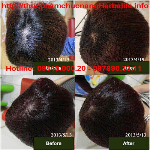 Hiệu quả khi sử dụng Aqua Herbalife với tóc ngắn